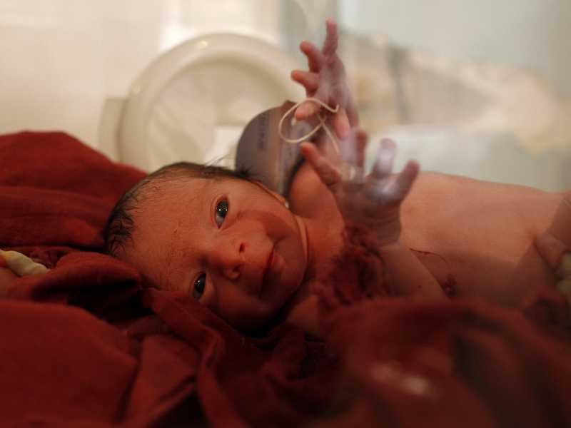 Un neonato prematuro in un'incubatrice nel reparto di neonatologia dell'ospedale di maternità Malalai a Kabul, in Afghanistan (Paula Bronstein/Getty Images)