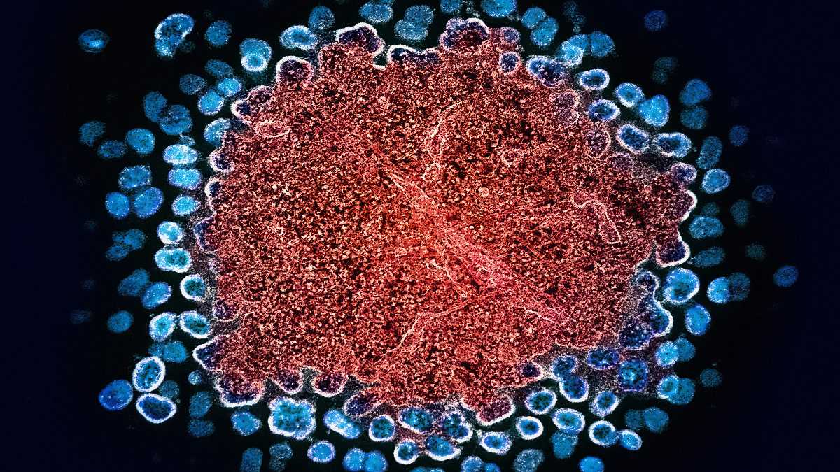 Immagine di Sottrarsi alla selezione naturale grazie alla medicina. Uno studio sull'Hiv