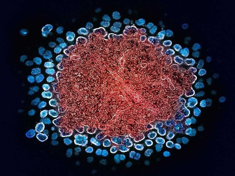 Foto di National Institute of Allergy and Infectious Diseases